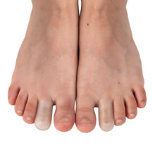 Load image into Gallery viewer, Cone Shaped Gel Digital Caps